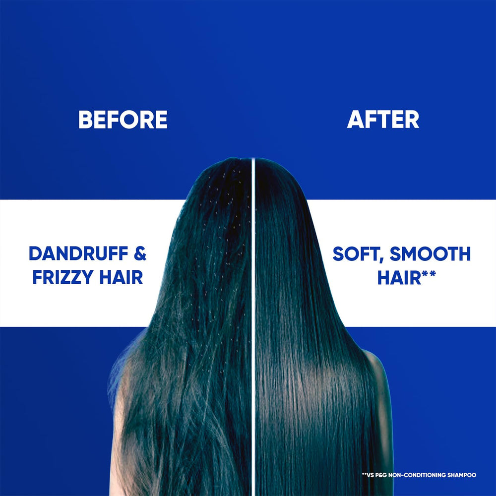 Head & Shoulders Smooth & Silky Anti-Dandruff Shampoo with Free Shampoo worth ₹82 Up to 100% Dandruff Protection