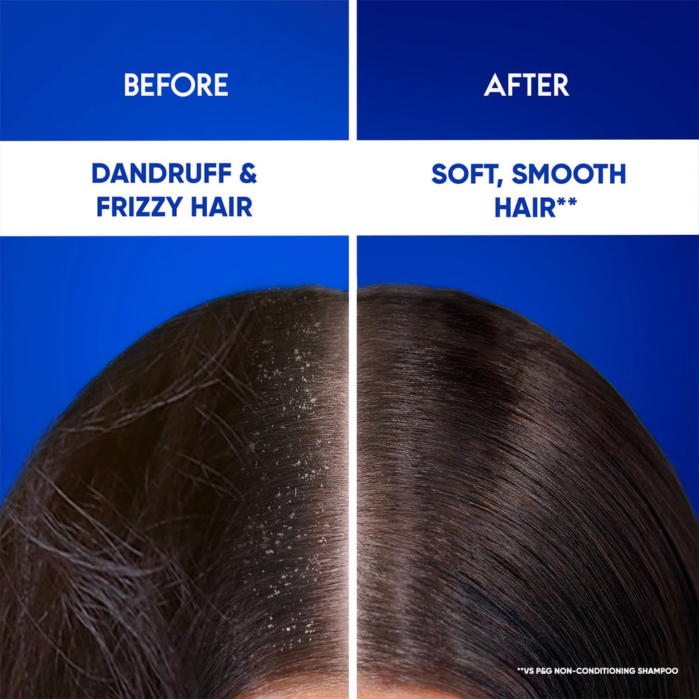 Head & Shoulders Smooth & Silky Anti-Dandruff Shampoo with Free Shampoo worth ₹82 Up to 100% Dandruff Protection