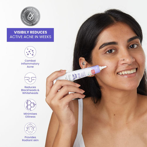Acne Star Gel 22g | Anti Acne & Pimple Treatment | Reduces Blackheads, Whiteheads & Oily Skin |
