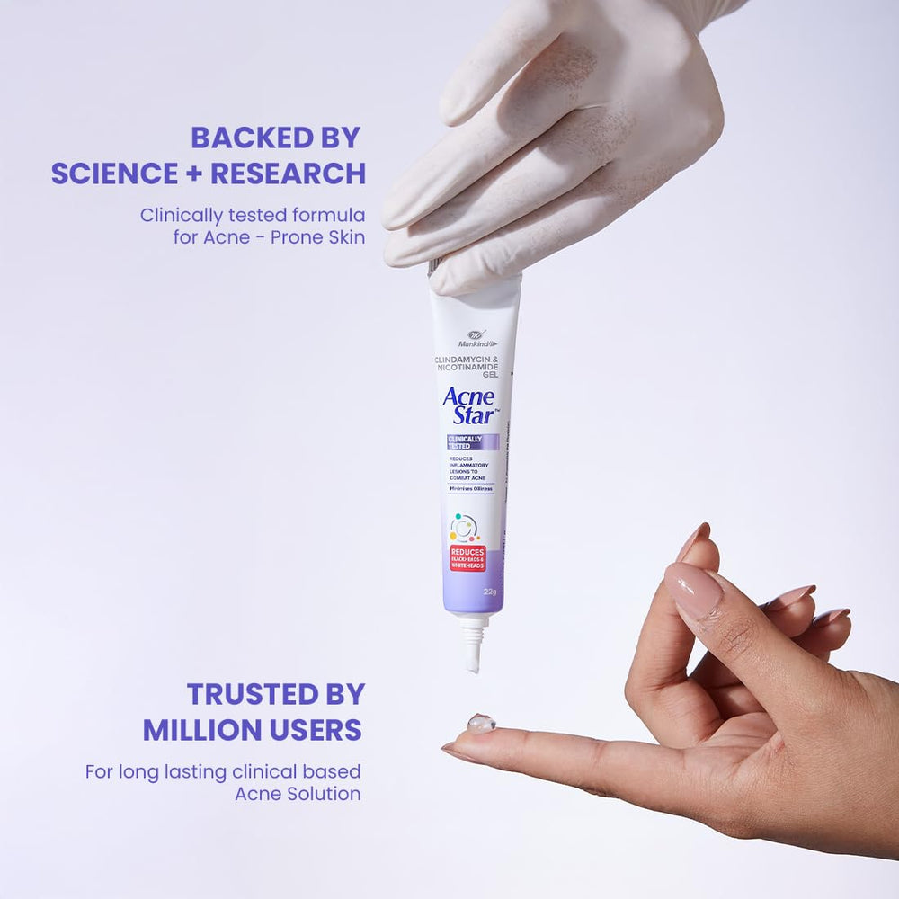 Acne Star Gel 22g | Anti Acne & Pimple Treatment | Reduces Blackheads, Whiteheads & Oily Skin |